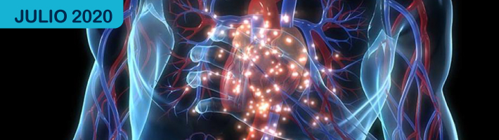 ¿Qué puedo hacer para evitar un infarto de miocardio o un accidente vascular cerebral?