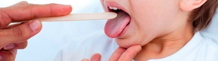 ¿Qué es el Streptococcus pyogenes? ¿Qué es el Streptococcus pyogenes?